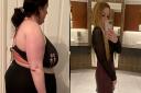 Claire Ball, 36, before and after her weight loss surgery