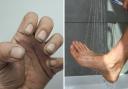Finger nails and legs were among the places not being washed enough by people in the shower, according to a doctor on TikTok.