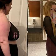 Claire Ball, 36, before and after her weight loss surgery