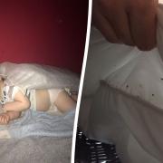 The family-of-four are covered in bedbugs
