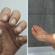 Finger nails and legs were among the places not being washed enough by people in the shower, according to a doctor on TikTok.